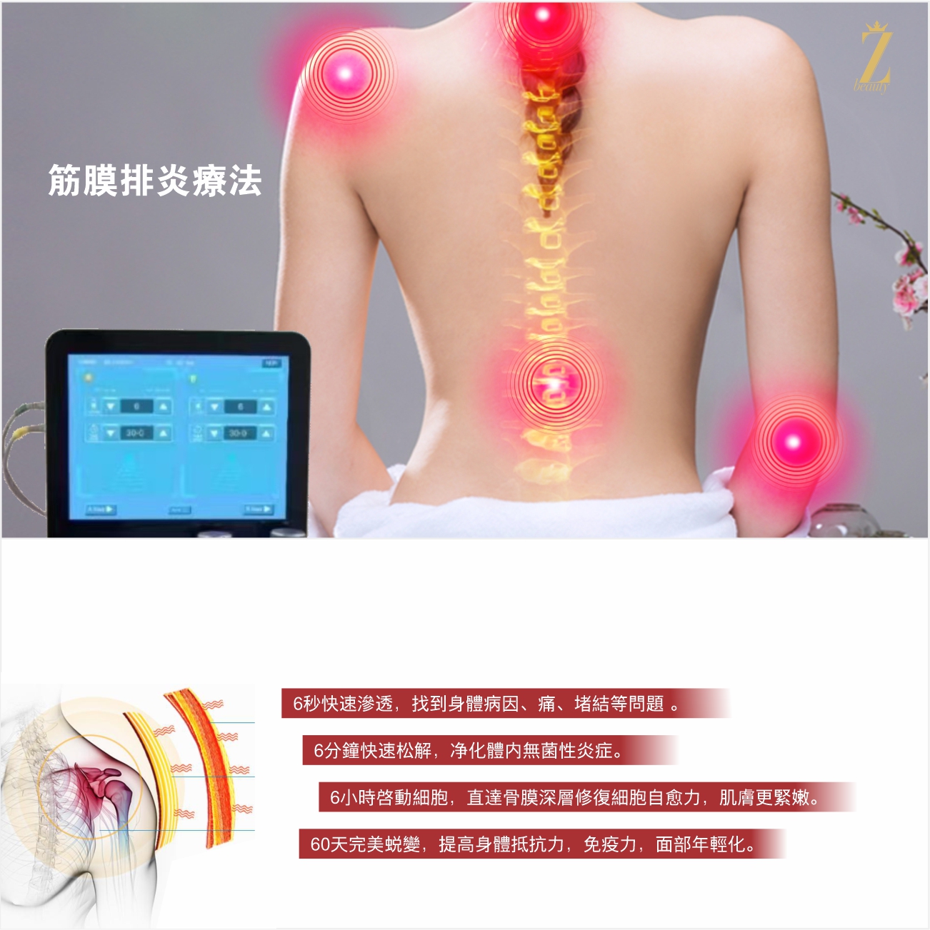 筋膜排炎療法